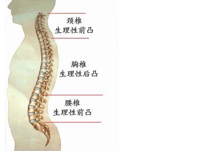 腰反弓|腰椎反弓怎么矫正